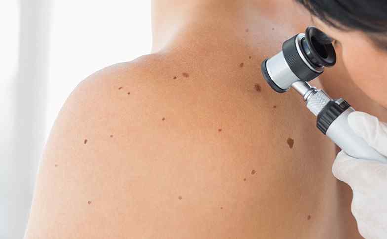 Ssc Banner Skin Screening Image